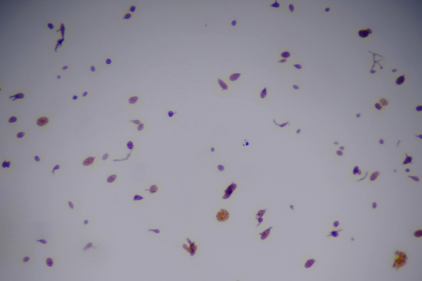 物联网孢子捕捉仪图片2